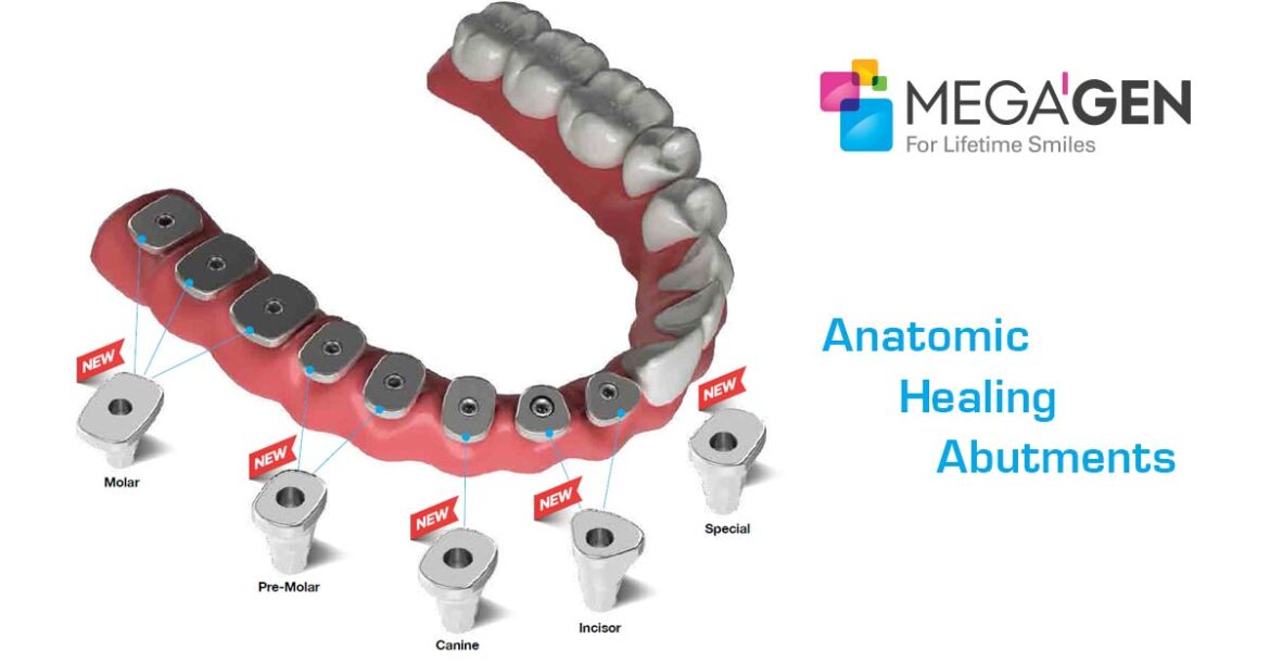 Οδοντιατρική Έδρα Castellini Puma Eli Ambidextrous – cervico type healing abutments